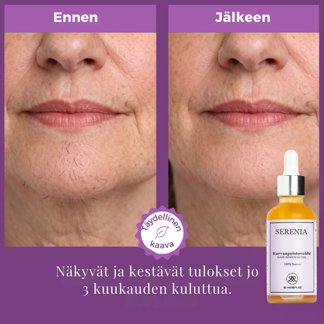 YÖAIKAISE KARVANPOISTOÖLJY - Karvojen pysyvä poistuminen!
