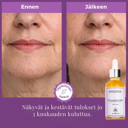 YÖAIKAISE KARVANPOISTOÖLJY - Karvojen pysyvä poistuminen!